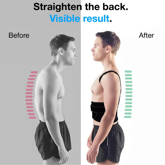 Adjustable Back Posture Corrector – Relieve Back & Shoulder Pain Instantly